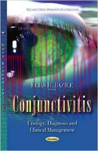 [AME]Conjunctivitis: Etiology, Diagnosis and Clinical Management