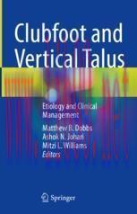 [PDF]Clubfoot and Vertical Talus: Etiology and Clinical Management