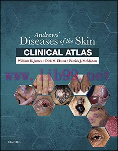 [AME]Andrews' Diseases of the Skin Clinical Atlas (PDF)