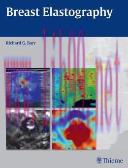 [AME]Breast Elastography (ORIGINAL PDF from_ Publisher)