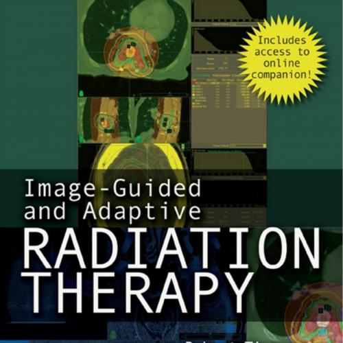 Image-Guided and Adaptive Radiation Therapy