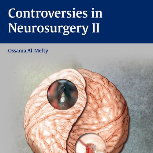 Thieme_ Controversies in Neurosurgery II