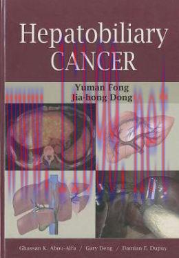 [AME]Hepatobiliary Cancer