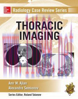 [AME]Radiology Case Review Series: Thoracic Imaging (EPUB)