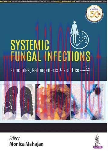 [AME]Systemic Fungal Infections: Principles, Pathogenesis & Practice (Original PDF)