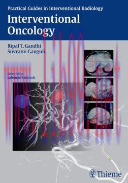 [AME]Interventional Oncology (Practical Guides in Interventional Radiology)