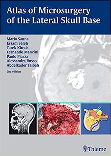 Atlas of Microsurgery of the Lateral Skull Base, 2e [Thieme] [2007]