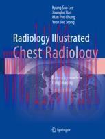 [PDF]Radiology Illustrated: Chest Radiology: Pattern Approach for Lung Imaging