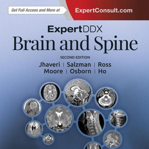ExpertDDx Brain and Spine 2nd E-Book
