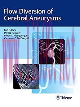 [PDF]Flow Diversion of Cerebral Aneurysms