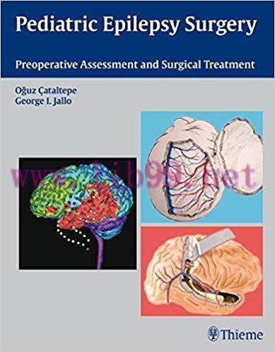 [PDF]Pediatric Epilepsy Surgery: Preoperative Assessment and Surgical Treatment