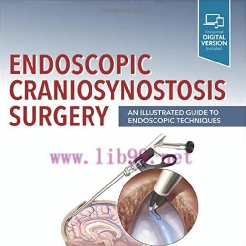 [PDF]Endoscopic Craniosynostosis Surgery: An Illustrated Guide to Endoscopic Techniques 1st Edi...