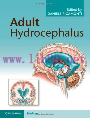 [AME]Adult Hydrocephalus (Cambridge Medicine)