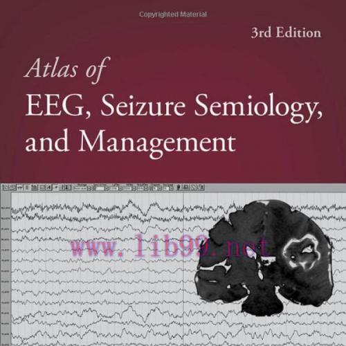 [AME]Atlas of EEG, Seizure Semiology, and Management, 3rd Edition (Original PDF)