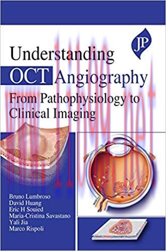 [AME]Understanding OCT Angiography from_ Pathophysiology to Clinical Imaging (Original PDF)
