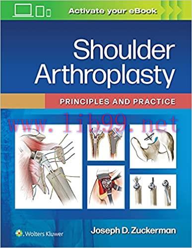 [PDF]Shoulder Arthroplasty Principles and Practice [Joseph D. Zuckerman]