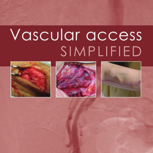 Vascular Access Simplified 2nd Edition - Edited by Alun H Davies & Christopher P Gibbons