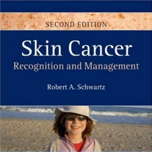 Skin Cancer- Recognition and Management