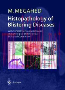 [AME]Histopathology of Blistering Diseases: With Clinical, Electron Microscopic, Immunological ...