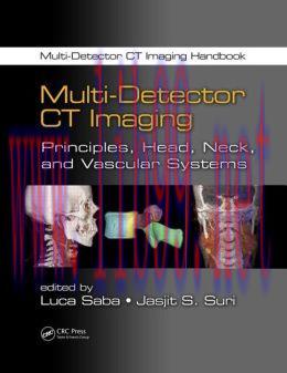 [AME]Multi-Detector CT Imaging: Principles, Head, Neck, and Vascular Systems