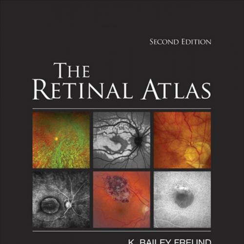 Retinal Atlas, 2nd Edition by K. Bailey Freund, The