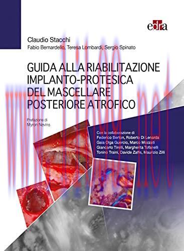 [AME]Guida alla riabilitazione implantoprotesica del mascellare posteriore atrofico (EPUB3 + Co...