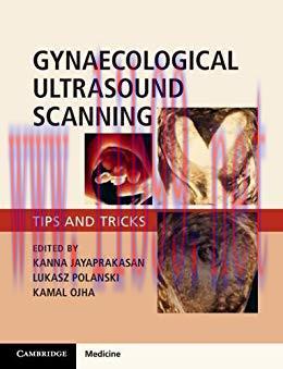 [PDF]Gynaecological Ultrasound Scanning Tips and Tricks
