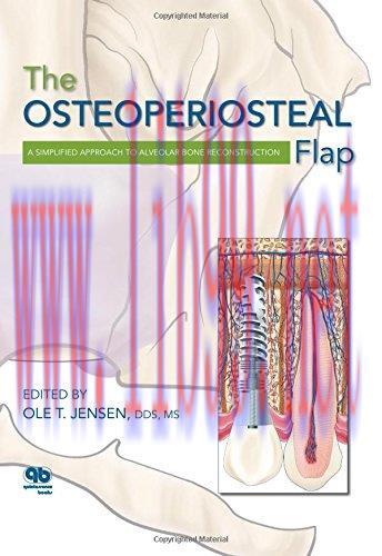 [AME]The Osteoperiosteal Flap: A Simplified Approach to Alveolar Bone Reconstruction (EPUB)
