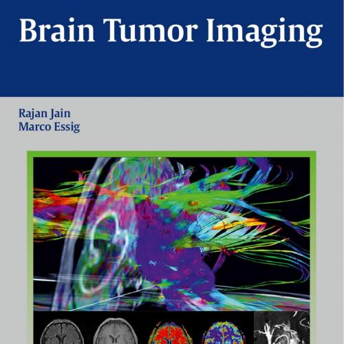 Brain Tumor Imaging