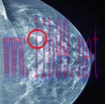 [AME]UCSF Breast Imaging 2022 (CME VIDEOS)