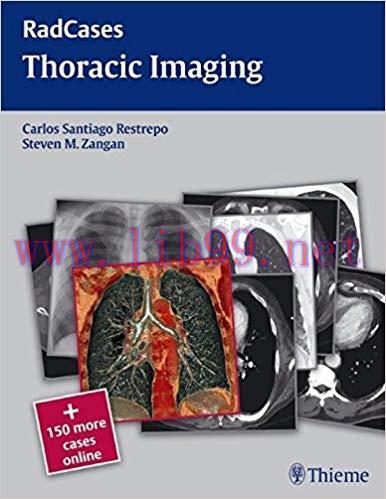 [PDF]Radcases Thoracic Imaging