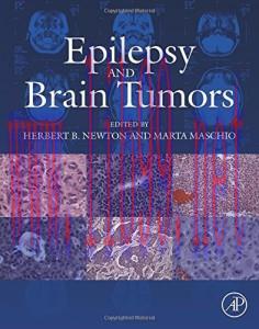 [AME]Epilepsy and Brain Tumors