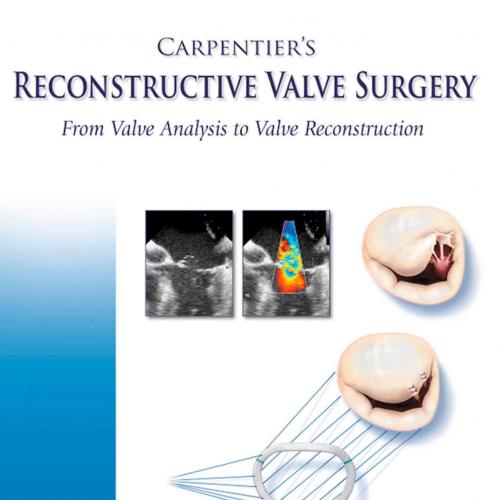 Carpentier''s Reconstructive Valve Surgery 1st
