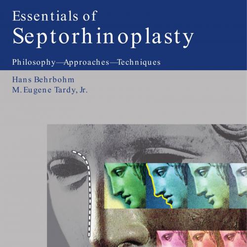 Essentials of Septorhinoplasty-Philosophy-Approaches-Techniques