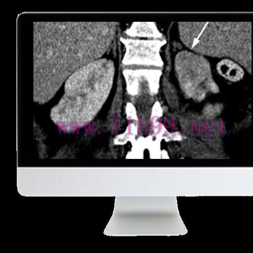 [AME]Abdominal and Thoracic Imaging Guidelines Applied: Evidence Versus Opinion 2021 (CME VIDEO...