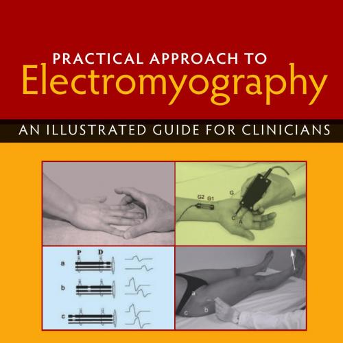 Practical Approach to Electromyography