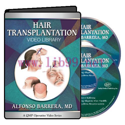 [AME]QMP Hair Transplantation 2017 (Videos)