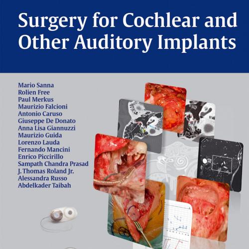Thieme_ Surgery for Cochlear and Other Auditory Implants - Sanna, Mario; Paul Merkus; Rolien Fr...