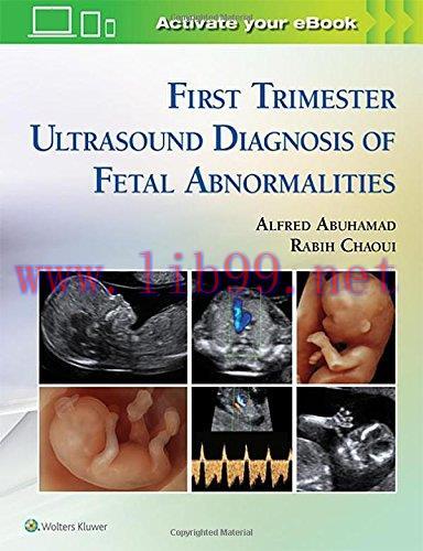 [AME]First Trimester Ultrasound Diagnosis of Fetal Abnormalities (EPUB)