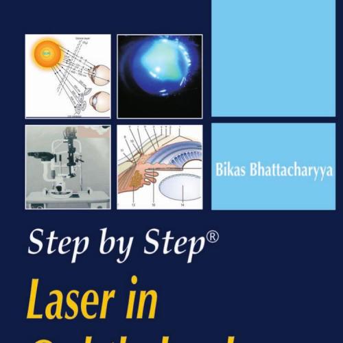 Step by Step(r) Laser in Ophthalmology