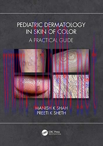 [AME]Pediatric Dermatology in Skin of Color: A Practical Guide (Original PDF)