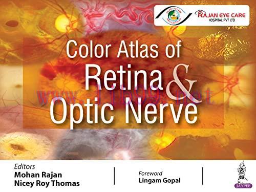 [AME]Color Atlas of Retina and Optic Nerve (Original PDF)