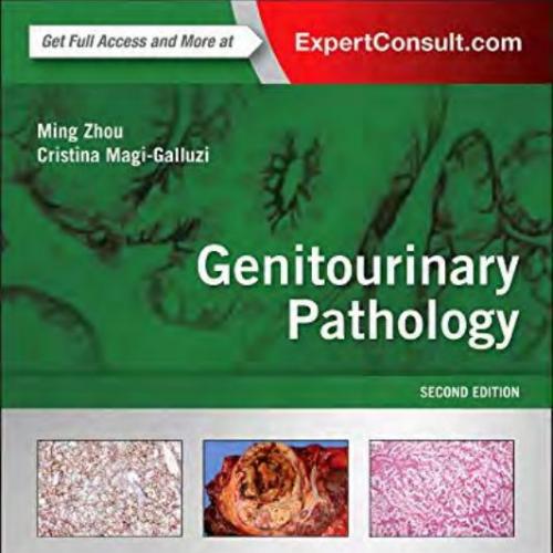 Genitourinary Pathology Foundations in Diagnostic Pathology, 2nd Edition