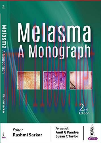 [AME]Melasma: A Monograph, 2nd Edition (Original PDF)