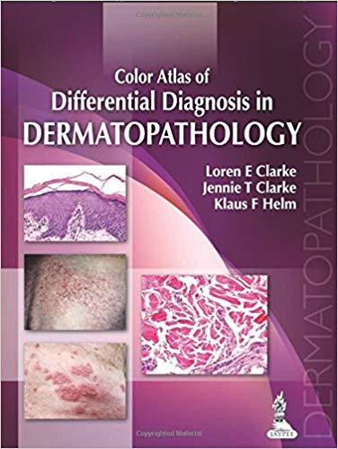 Color Atlas of Differential Diagnosis in Dermatopathology