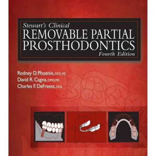 Stewarts Clinical Removable Partial Prosthodontic 4th Edition