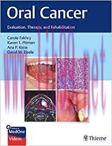 [AME]Oral Cancer: Evaluation, Therapy, and Rehabilitation (EPUB)