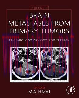 [AME]Brain Metastases from_ Primary Tumors, Volume 1: Epidemiology, Biology, and Therapy (ORIGI...