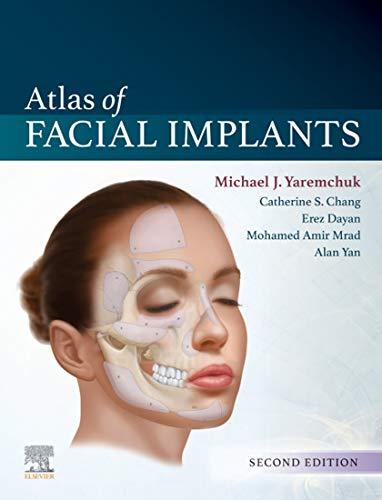 Atlas of Facial Implants, 2nd ed