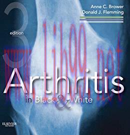 (PDF)Arthritis in Black and White E-Book
